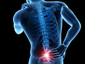 Causas de dolor lumbar
