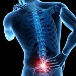 Causas de dolor lumbar