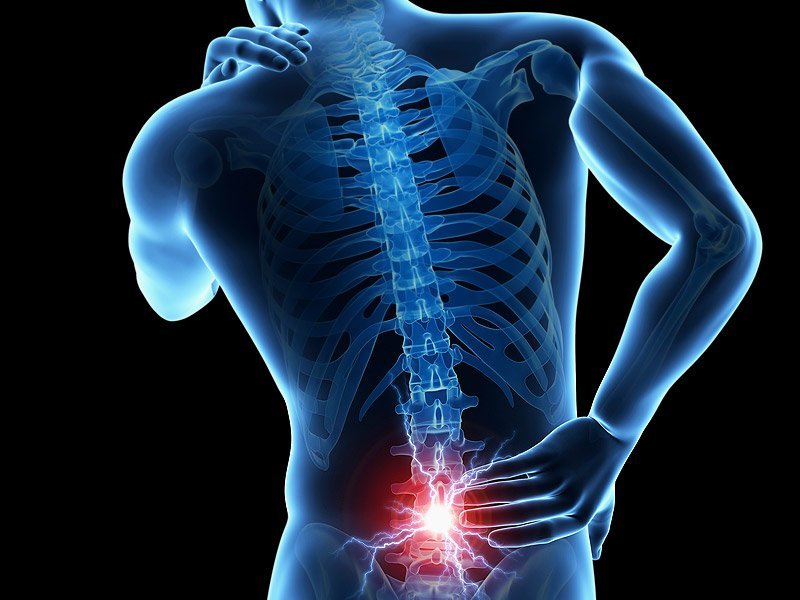 Causas de dolor lumbar